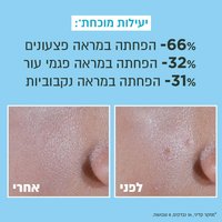 יעילות מוכחת. מינוס 66 אחוז הפחתה במראה פצעונים. מינוס 32 אחוז הפחתה במראה פגמי עור. מינוס 31 אחוז הפחתה במראה נקבוביות. תמונה המציגה מראה עור לפני ואחרי שימוש במוצר. מחקר קליני, 34 נבדקים, 8 שבועות.