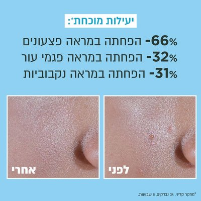 יעילות מוכחת. מינוס 66 אחוז הפחתה במראה פצעונים. מינוס 32 אחוז הפחתה במראה פגמי עור. מינוס 31 אחוז הפחתה במראה נקבוביות. תמונה המציגה מראה עור לפני ואחרי שימוש במוצר. מחקר קליני, 34 נבדקים, 8 שבועות.