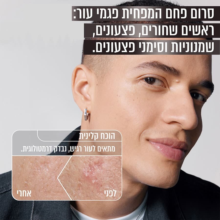 סרום פחם המפחית פגמי עור, ראשים שחורים, פצעונים, שמנוניות וסימני פצעונים. הוכח קלינית, מתאים לעור רגיש, נבדק דרמטולוגית.