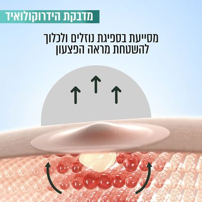 מדבקת הידרוקולואיד מסייעת בספיגת נוזלים ולכלוך להשטחת מראה הפצעון.