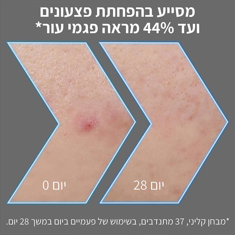 מסייע בהפחתת פצעונים ועד 44% מראה פגמי עור. מבחן קליני, 37 מתנדבים בשימוש של פעמיים ביום במשך 28 ימים.