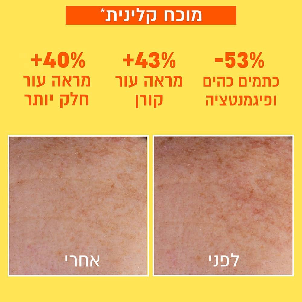 מוכח קלינית. מינוס 53 אחוז כתמים כהים ופיגמנטציה. פלוס 43 אחוז מראה עור קורן. פלוס 40 אחוז מראה עור חלק יותר. תצוגת תקריב של עור פנים לפני ואחרי שימוש במוצר.