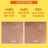 מוכח קלינית. מינוס 53 אחוז כתמים כהים ופיגמנטציה. פלוס 43 אחוז מראה עור קורן. פלוס 40 אחוז מראה עור חלק יותר. תצוגת תקריב של עור פנים לפני ואחרי שימוש במוצר.